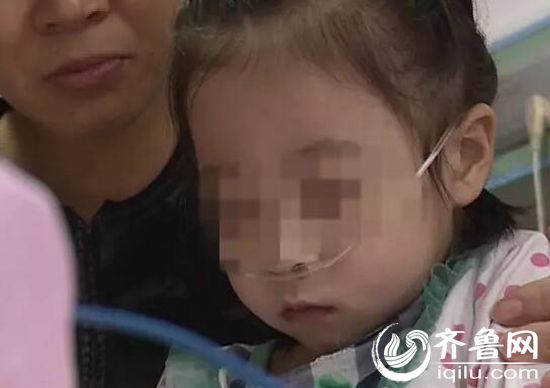 山东一6岁女孩肺功能衰竭如八旬老人